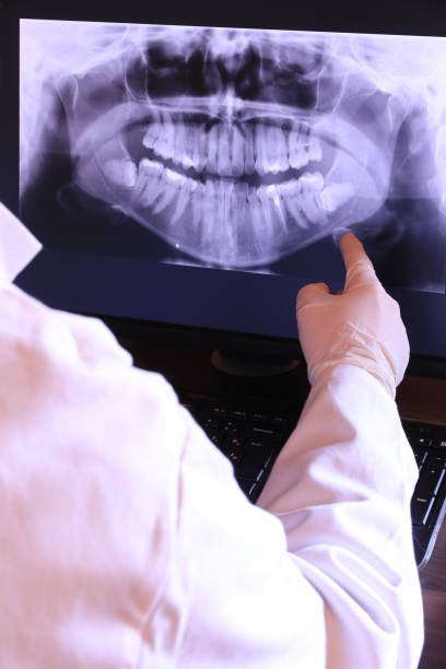 Best Chipped Tooth Repair Near Me  in Honsville, GA