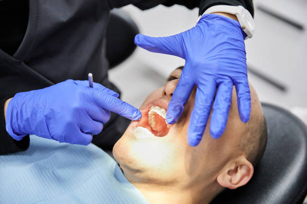 Best Teeth Whitening  in Honsville, GA