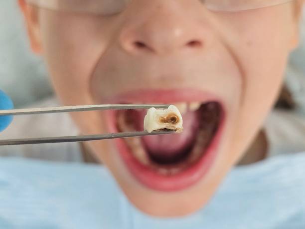 Best Broken Tooth Emergency  in Honsville, GA